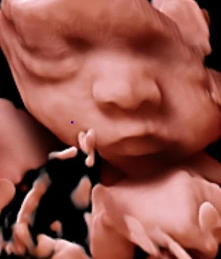 ultrasonic Scanner ultrasonic Scanner