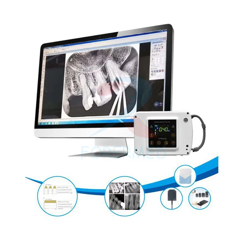 Opg Dental X Ray