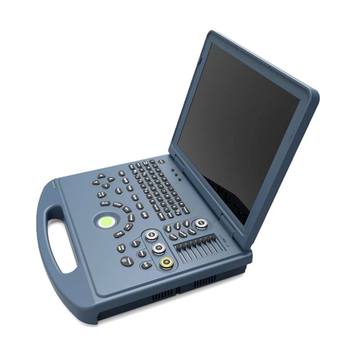 Laptop Ultrasound Scanner Laptop Ultrasound Scanner