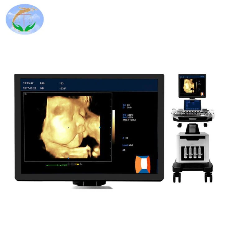 Scanner de ultrassom Doppler colorido 4D de boas vendas
