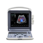 Scanner Doppler colorido portátil 3D/4D