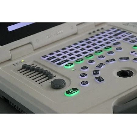 Full-Digital Laptop Ultrasound Scanner Full-Digital Laptop Ultrasound Scanner