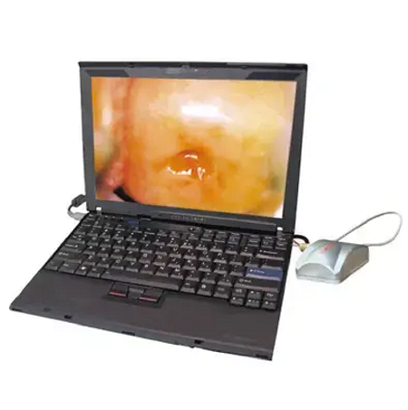 Sony Medical Hospital Colposcope Sony Medical Hospital Colposcope