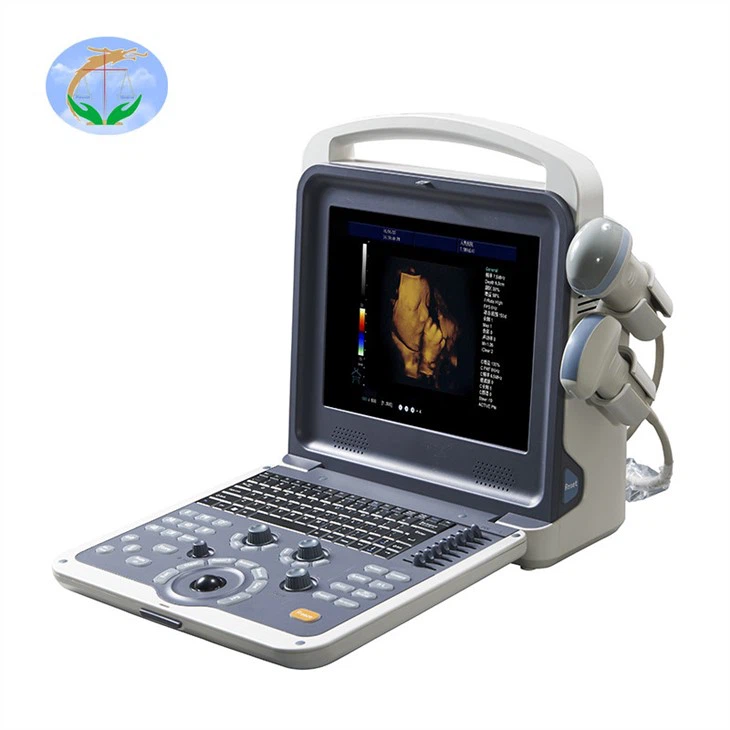 4D Color Doppler Full Digital Color Doppler Ultrasound Diagnostic System 4D Color Doppler Full Digital Color Doppler Ultrasound Diagnostic System